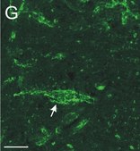 Anti-Chondroitin Sulfate Proteoglycan Antibody, Brain (core protein), clone Cat-301 clone Cat-301, Chemicon&#174;, from mouse