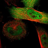 Anti-SGSM2 antibody produced in rabbit Prestige Antibodies&#174; Powered by Atlas Antibodies, affinity isolated antibody, buffered aqueous glycerol solution, Ab1