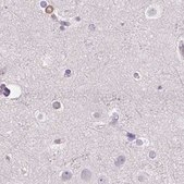 Anti-PRL antibody produced in rabbit Prestige Antibodies&#174; Powered by Atlas Antibodies, affinity isolated antibody