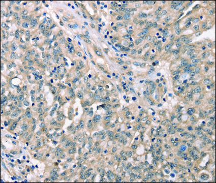 Anti-CDK12 antibody produced in rabbit affinity isolated antibody