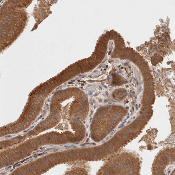 Anti-KLHL20 antibody produced in rabbit Prestige Antibodies&#174; Powered by Atlas Antibodies, affinity isolated antibody, buffered aqueous glycerol solution
