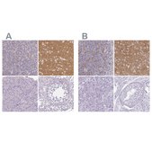 Anti-VGLUT1 antibody produced in rabbit Prestige Antibodies&#174; Powered by Atlas Antibodies, affinity isolated antibody, buffered aqueous glycerol solution