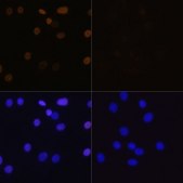 Anti-Acetyl-Histone H4-K16 antibody produced in rabbit