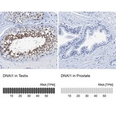 Anti-DNAI1 antibody produced in rabbit Prestige Antibodies&#174; Powered by Atlas Antibodies, affinity isolated antibody, buffered aqueous glycerol solution, Ab2