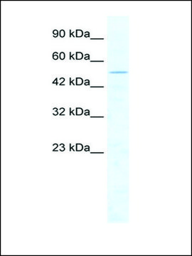 Anti-CHD1L antibody produced in rabbit IgG fraction of antiserum