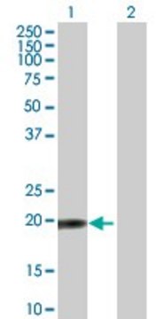 Anti-TPRKB antibody produced in mouse purified immunoglobulin, buffered aqueous solution