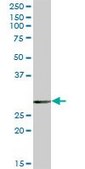 Anti-EPDR1 antibody produced in mouse purified immunoglobulin, buffered aqueous solution