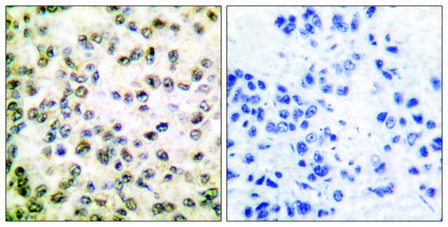 Anti-CREB-BP antibody produced in rabbit affinity isolated antibody