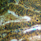 Anti-phospho-PPAR-&#947; (pSer112) antibody produced in rabbit affinity isolated antibody