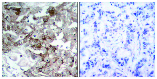 Anti-Cortactin antibody produced in rabbit affinity isolated antibody