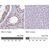 Anti-RALY antibody produced in rabbit Prestige Antibodies&#174; Powered by Atlas Antibodies, affinity isolated antibody, buffered aqueous glycerol solution