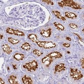 Anti-SLC7A9 antibody produced in rabbit Prestige Antibodies&#174; Powered by Atlas Antibodies, affinity isolated antibody, buffered aqueous glycerol solution