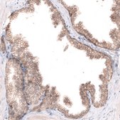 Monoclonal Anti-CLDN1 antibody produced in mouse Prestige Antibodies&#174; Powered by Atlas Antibodies, clone CL3698, purified immunoglobulin, buffered aqueous glycerol solution