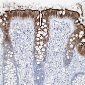 Anti-SLC26A3 antibody produced in rabbit Prestige Antibodies&#174; Powered by Atlas Antibodies, affinity isolated antibody, buffered aqueous glycerol solution