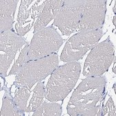 Anti-CSN2 antibody produced in rabbit Prestige Antibodies&#174; Powered by Atlas Antibodies, affinity isolated antibody, buffered aqueous glycerol solution