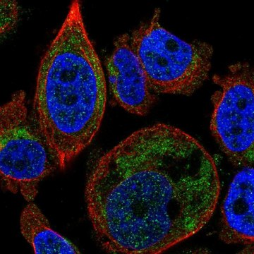 Anti-SLC25A16 antibody produced in rabbit Prestige Antibodies&#174; Powered by Atlas Antibodies, affinity isolated antibody