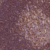 Anti-CD45 antibody produced in rabbit Prestige Antibodies&#174; Powered by Atlas Antibodies, affinity isolated antibody, buffered aqueous glycerol solution