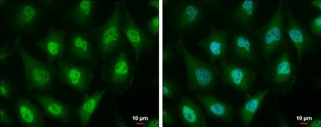 Monoclonal Anti-ID3 antibody produced in mouse