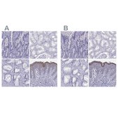 Anti-LOR Prestige Antibodies&#174; Powered by Atlas Antibodies, affinity isolated antibody