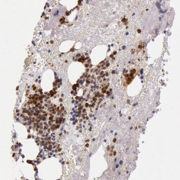 Anti-KDM6A antibody produced in rabbit Prestige Antibodies&#174; Powered by Atlas Antibodies, affinity isolated antibody, buffered aqueous glycerol solution