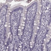 Anti-TRPM1 antibody produced in rabbit Prestige Antibodies&#174; Powered by Atlas Antibodies, affinity isolated antibody