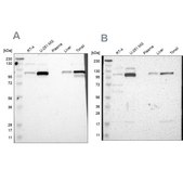 Anti-PRKCA antibody produced in rabbit Ab1, Prestige Antibodies&#174; Powered by Atlas Antibodies, affinity isolated antibody, buffered aqueous glycerol solution