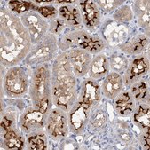 Anti-RWDD2A antibody produced in rabbit Prestige Antibodies&#174; Powered by Atlas Antibodies, affinity isolated antibody, buffered aqueous glycerol solution, ab3