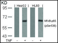 Anti-phospho-RELA (p65/pSer536) antibody produced in rabbit affinity isolated antibody