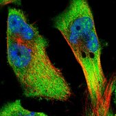 Anti-CKAP4 antibody produced in rabbit Prestige Antibodies&#174; Powered by Atlas Antibodies, affinity isolated antibody