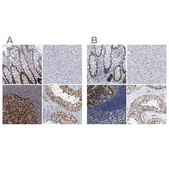 Anti-PCNA antibody produced in rabbit Prestige Antibodies&#174; Powered by Atlas Antibodies, affinity isolated antibody, buffered aqueous glycerol solution, ab2