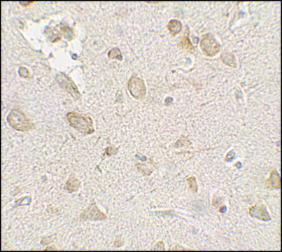 Anti-FMR1 antibody produced in rabbit affinity isolated antibody