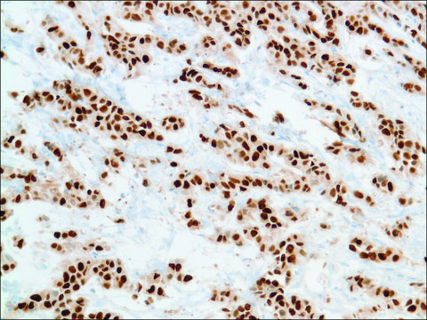 Anti-Progesterone Receptor antibody, Rabbit monoclonal recombinant, expressed in proprietary host, clone SP2, tissue culture supernatant