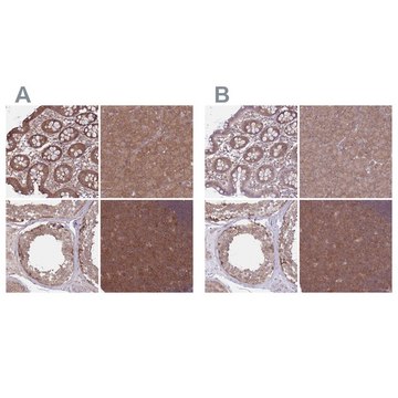 Anti-PFDN6 antibody produced in rabbit Prestige Antibodies&#174; Powered by Atlas Antibodies, affinity isolated antibody, buffered aqueous glycerol solution