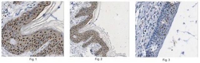 Anti-Galectin-7 Antibody from rabbit, purified by affinity chromatography