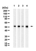 Anti-CAM kinase II Delta Antibody, clone 1E22 ZooMAb&#174; Rabbit Monoclonal recombinant, expressed in HEK 293 cells