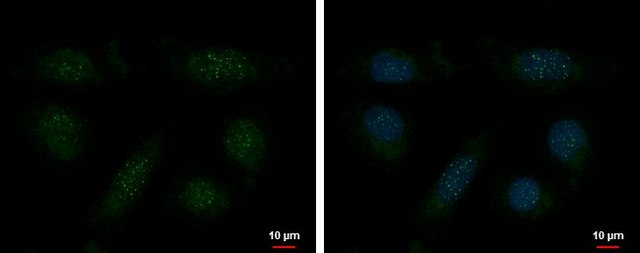 Monoclonal Anti-TERF1 antibody produced in mouse