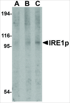 Anti-IRE1P (ab3) antibody produced in rabbit affinity isolated antibody, buffered aqueous solution