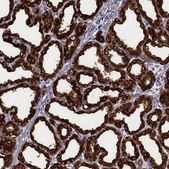 Anti-CSN3 antibody produced in rabbit Prestige Antibodies&#174; Powered by Atlas Antibodies, affinity isolated antibody, buffered aqueous glycerol solution