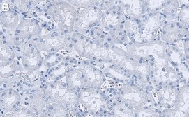 Anti-PDGF-C Antibody, clone 4D14 ZooMAb&#174; Rabbit Monoclonal recombinant, expressed in HEK 293 cells