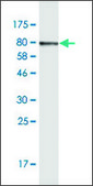 Monoclonal Anti-KRT6B antibody produced in mouse clone 3B6, purified immunoglobulin, buffered aqueous solution