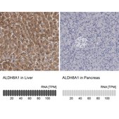 Anti-ALDH8A1 antibody produced in rabbit Prestige Antibodies&#174; Powered by Atlas Antibodies, affinity isolated antibody, buffered aqueous glycerol solution