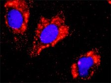 Anti-FLT1 antibody produced in rabbit purified immunoglobulin, buffered aqueous solution