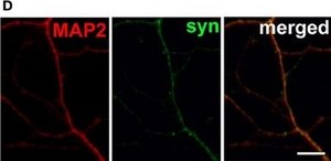 Anti-MAP2 Antibody, clone AP20 clone AP20, Chemicon&#174;, from mouse