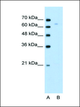 Anti-TOX antibody produced in rabbit affinity isolated antibody
