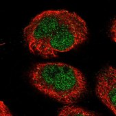 Anti-NEMP1 antibody produced in rabbit Prestige Antibodies&#174; Powered by Atlas Antibodies, affinity isolated antibody, buffered aqueous glycerol solution