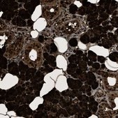 Anti-PHLDA1 antibody produced in rabbit Prestige Antibodies&#174; Powered by Atlas Antibodies, affinity isolated antibody, buffered aqueous glycerol solution