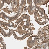 Anti-USP2 antibody produced in rabbit Ab1, Prestige Antibodies&#174; Powered by Atlas Antibodies, affinity isolated antibody, buffered aqueous glycerol solution