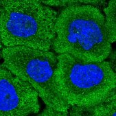 Anti-DAAM1 antibody produced in rabbit Prestige Antibodies&#174; Powered by Atlas Antibodies, affinity isolated antibody, buffered aqueous glycerol solution