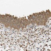 Anti-S100A6 antibody produced in rabbit Prestige Antibodies&#174; Powered by Atlas Antibodies, affinity isolated antibody, buffered aqueous glycerol solution