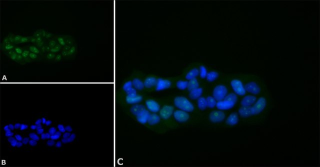 Anti-BACH1 antibody produced in rabbit affinity isolated antibody, buffered aqueous solution